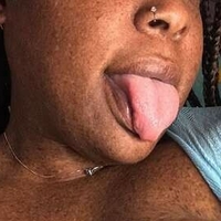 freckledfantasy5 Nackt