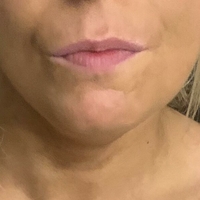 Holytits Nackt